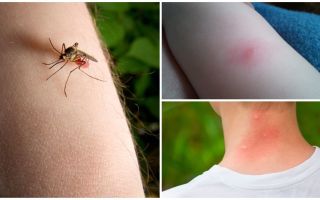 ¿Cuál es la diferencia entre una picadura de mosquito y una picadura de insecto o garrapata?
