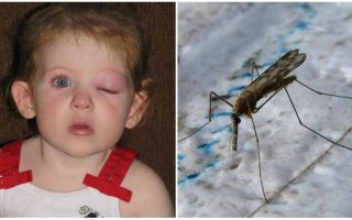Qué hacer si un niño tiene un ojo hinchado después de una picadura de mosquito