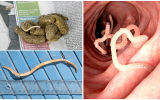 ¿Cómo se ven los gusanos redondos en las heces humanas?