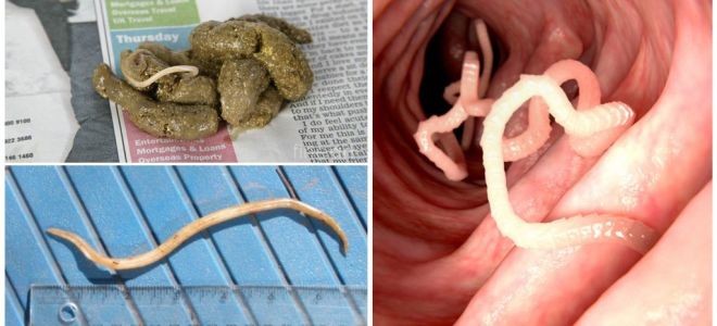 ¿Cómo se ven los gusanos redondos en las heces humanas?