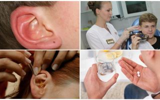 Garrapata en el oído de una persona: síntomas y tratamiento.