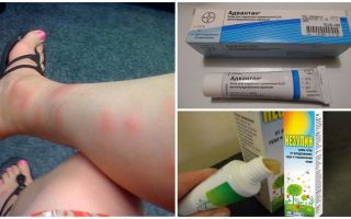 ¿Por qué en adultos y niños después de las picaduras de mosquitos aparecen bultos que tratar?