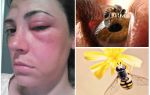 ¿Qué pasaría si una abeja mordiera el ojo y se hinchara?