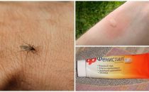 Cómo y cómo eliminar la picazón de las picaduras de mosquitos en un niño y un adulto